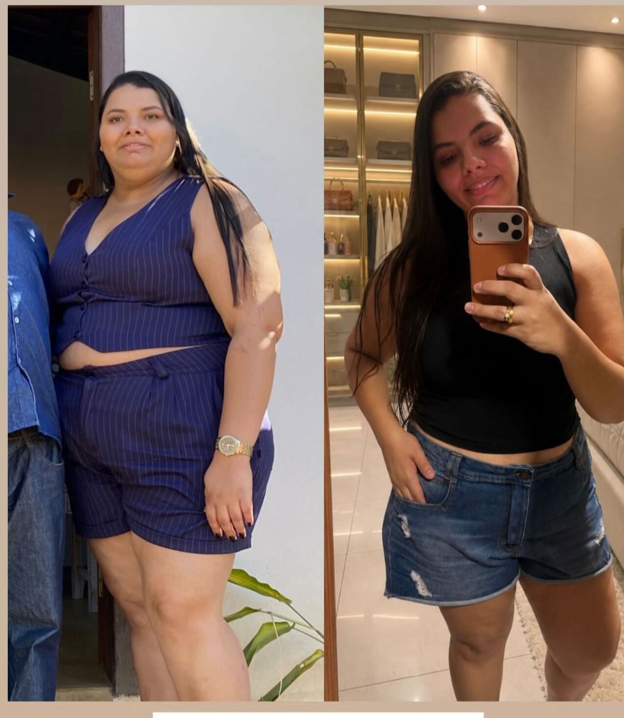 Antes e depois — Michele Carvalho